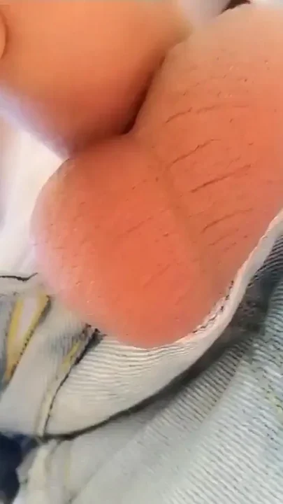 Peeing Into Foreskin Outdoor - Thats Looking Like Inflated Ballon