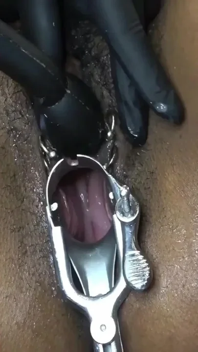 Dark Dea's wide open and wet pussy in a gyno-exam