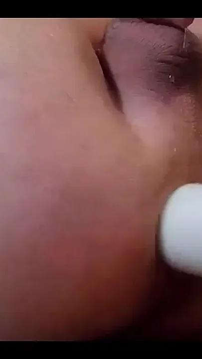 I Jerked My Hemorrhoidal Ass to Squirt