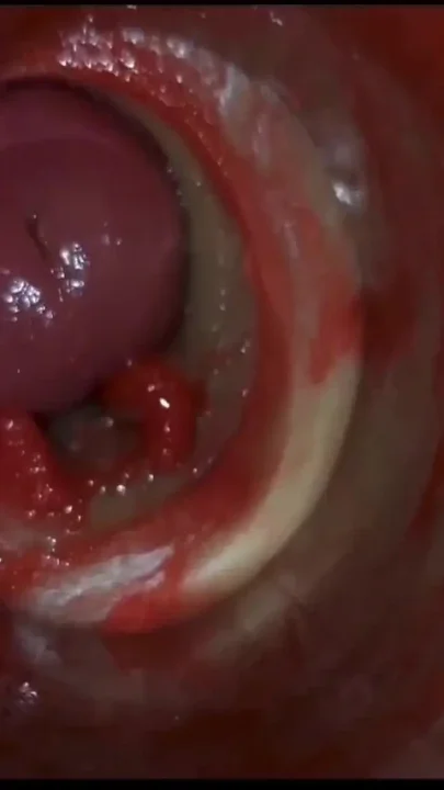 Compilation Creampie Part 8 POV
