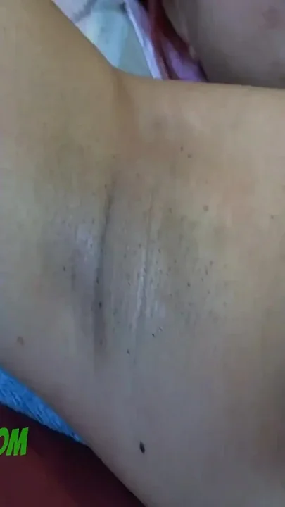 Armpits close up