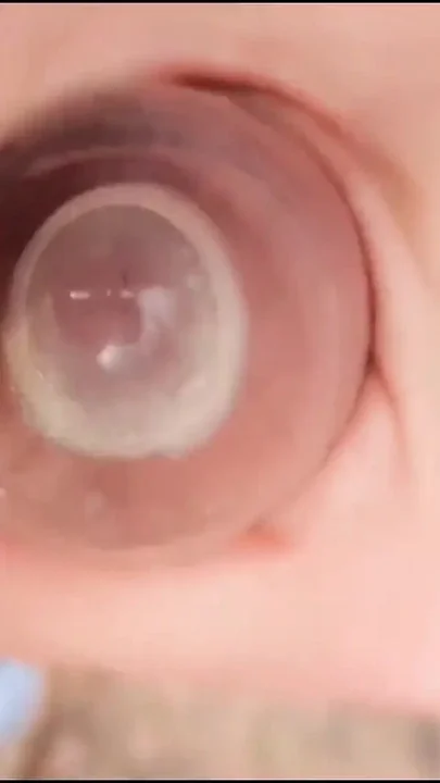 Edging with Condom It Is Creamy Precum Two Horny Cumshots and Foamy Cum Mess