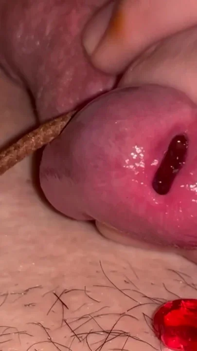 Inserting gummy bears an deep urethra sounding Clip 2
