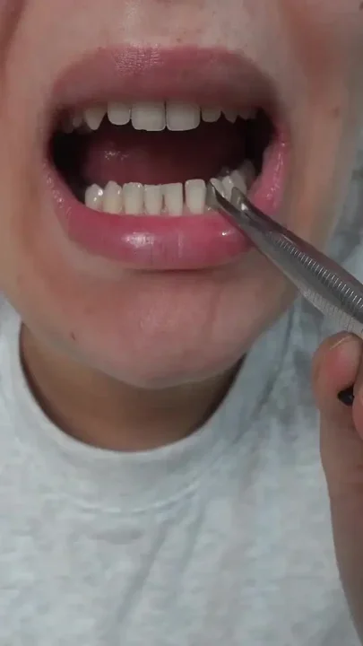 My Giantess Stepsister Plays Dentist with Tiny Stepbrother
