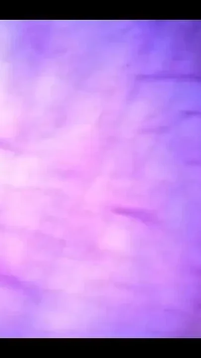 Beautiful Inside POV of My Full Bladder with the Endoscope