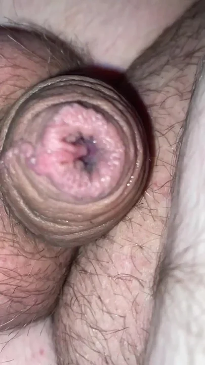 Small TIny Limp Clitty Dick Leaking Precum like a Real Sissy Clit Clip 1