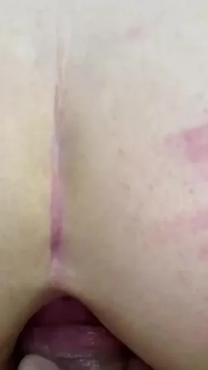 Outdoor hardcore anal Cumshot Public Blowjob Ass destroy Clip 1
