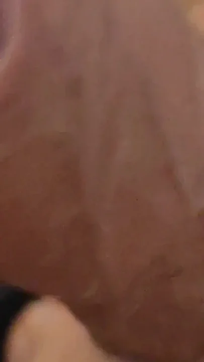 Immense Phimosis Being Extracted Cum and Précum