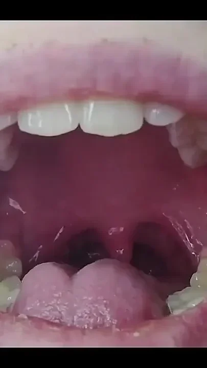 Throat Fetish