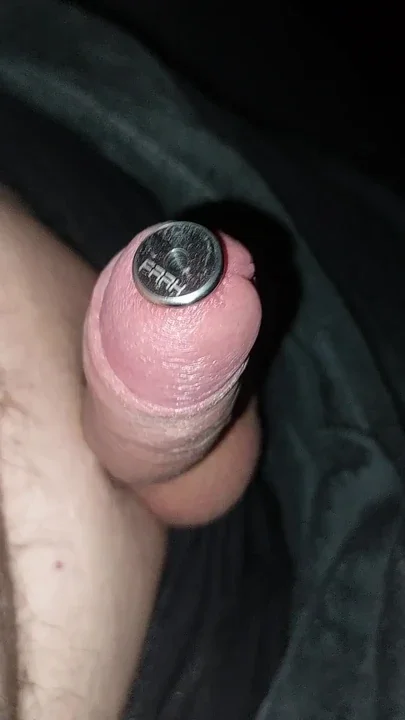Pre-discharge urethral dilation