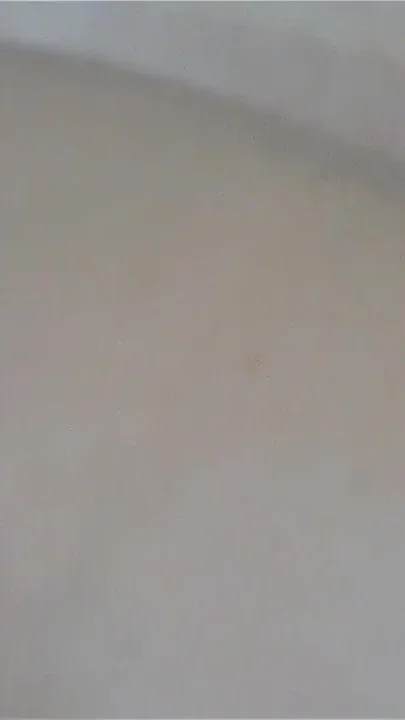 Nipples