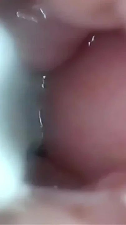 Semen in Cervix Wide Stretching Pussy Endoscope Clip 1