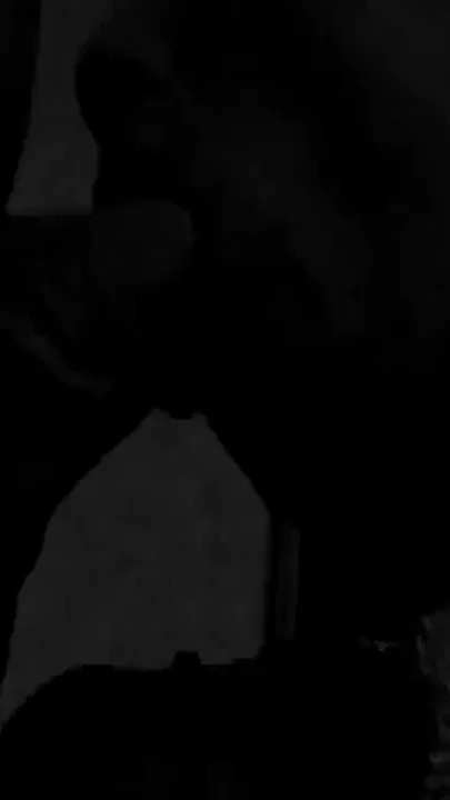 Gaping Anal Prolapse Dripping Thick Cum Loads