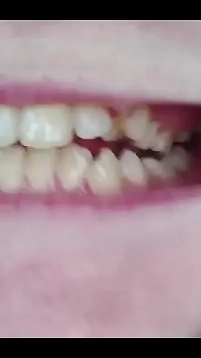 My Mouth Teeth Tongue and Throat up Close