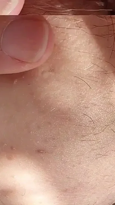 Solo Closeup