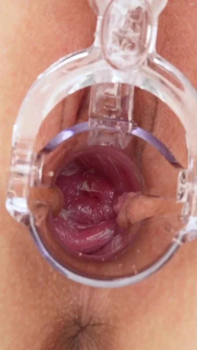Uteruscervix Look How I Am Inside Extreme Close-up