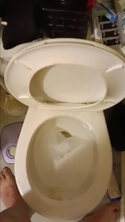 Peeing While in Shrinkage