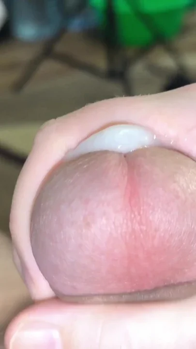 After snow and frost I warm up with hot water and rubbing Clip 2