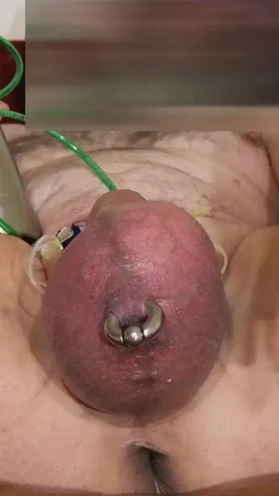 Inflating the scrotum that's fun Clip 2