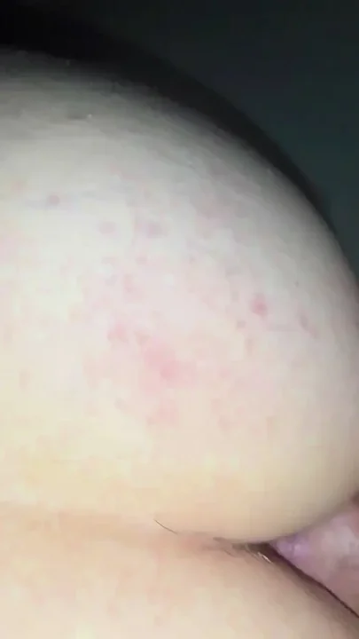 Wixxen Und Anal