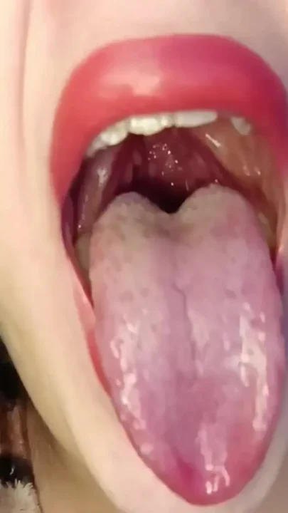 Consume Chews Gummies