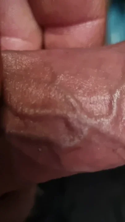 BWC veins omg