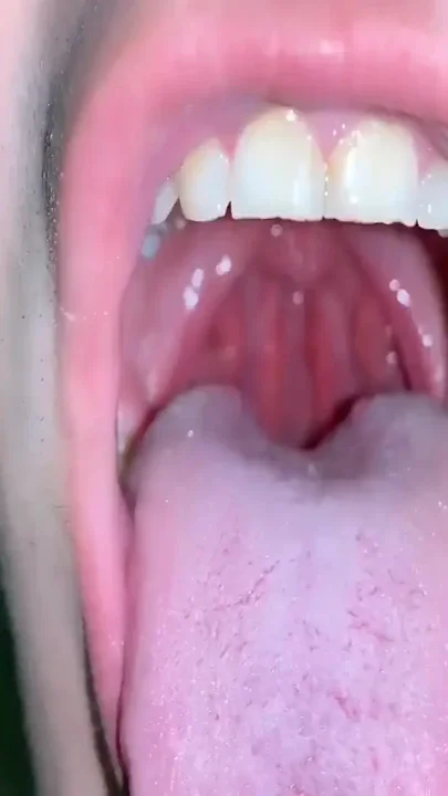 POV with Endoscope