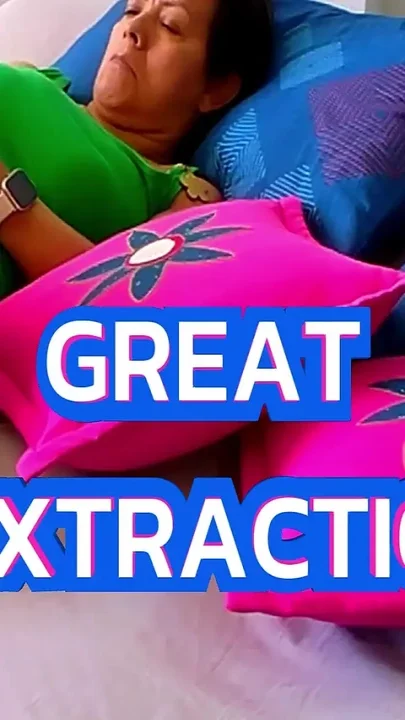Great Sextraction with Garabas and Olga
