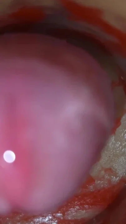 Insemination - Internal Camera Captures Deep Male Ejaculation Clip 1