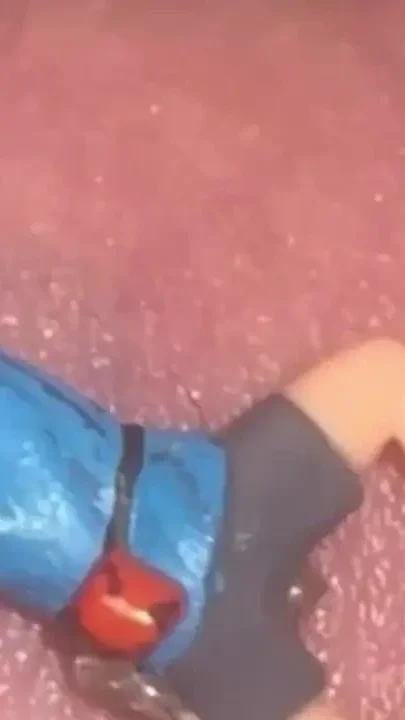 Tiny Parasite Guys Caught on Jules' Cock See How He Gets Rid of Them and Punish Them