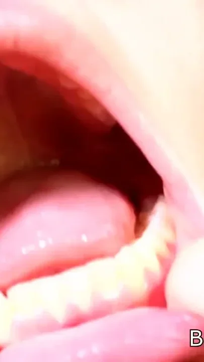 Inside Ashlynn's mouth