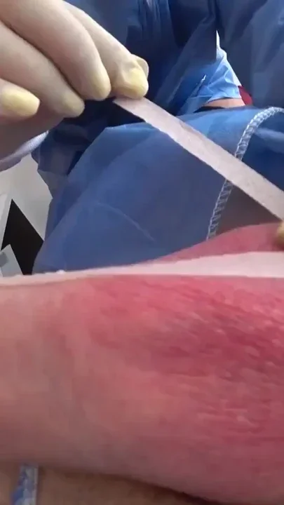 1 DAY HOT NURSE was Surprised by the Patient Hospital Clip 1