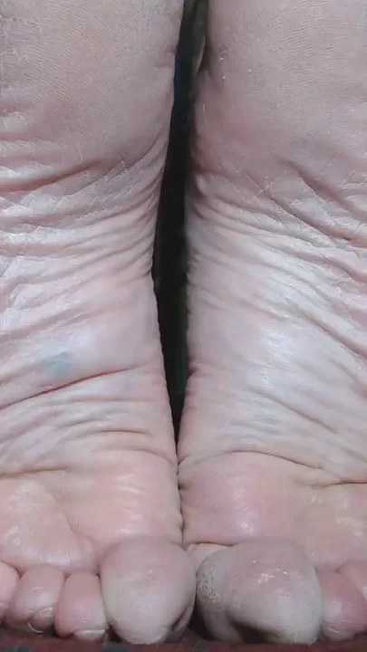 Extreme wrinkled soles closeup dry
