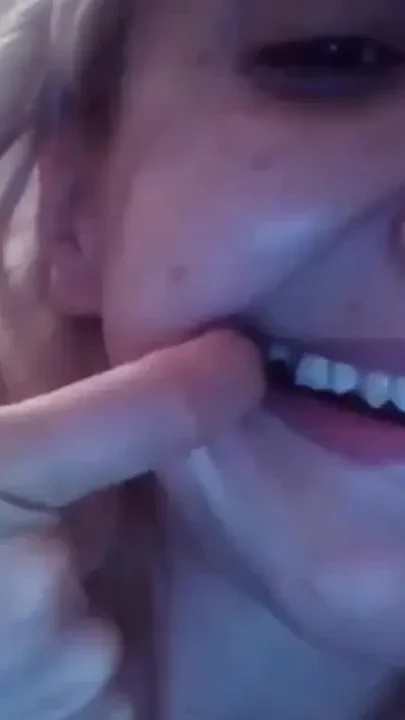 Beautiful Face but Rotten Teeth