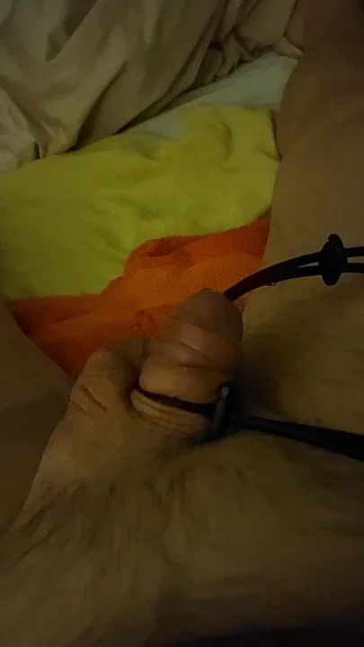 Electro stimulation e stim