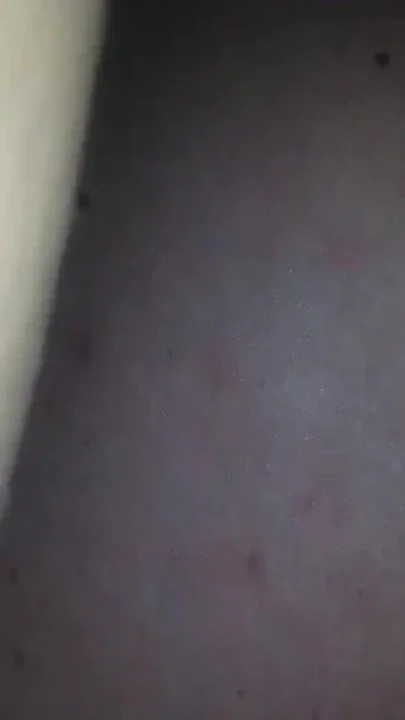 Getting Pegged