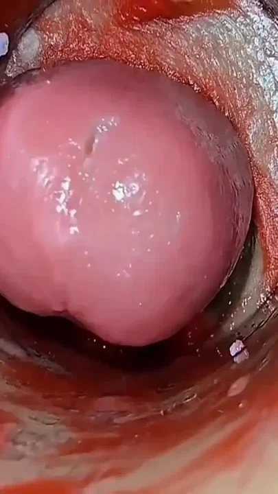 Cumfeti Dripping Creampie Compilation- Endoscopy View