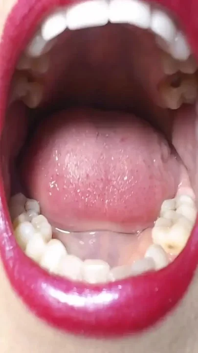 Big wide open mouth