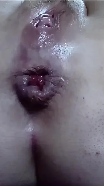 Watch Me Play with My Huge Anal Rosebud