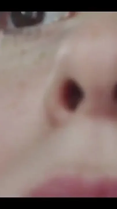Runny Nose Close up