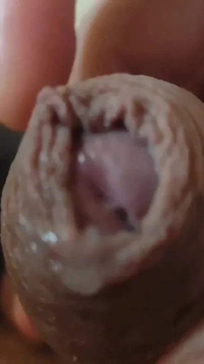 Great Phimosis Getting in the Way of the Boy's Orgasm