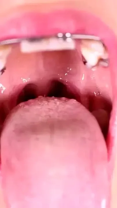 Inside her mouth Braces cuttie