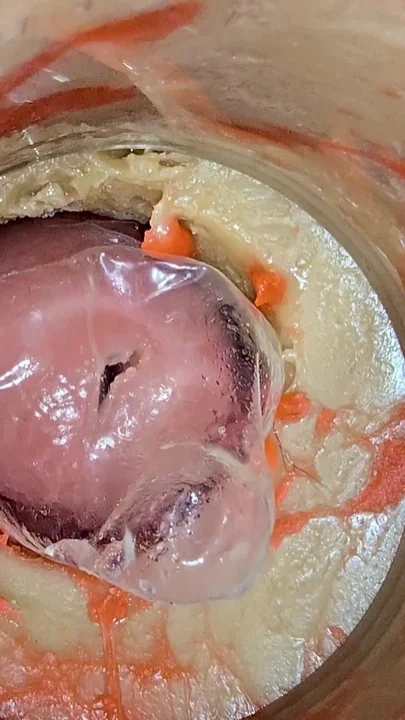 The Camera 4K Inside the Deep Pussy Records a Huge Ejaculation with a Stuck Condom