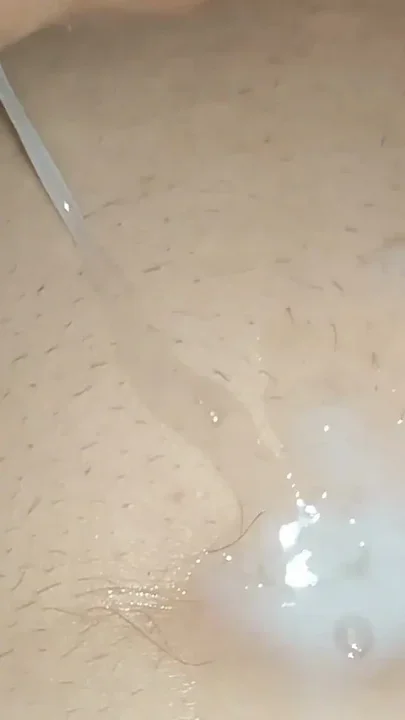 Masturbation and Cumshot Through the Phimosis Skin