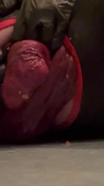 Sloppy loose prolapse Clip 1