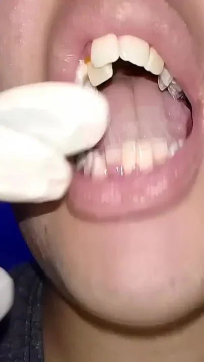 Trying to Use Dental Floss close-up