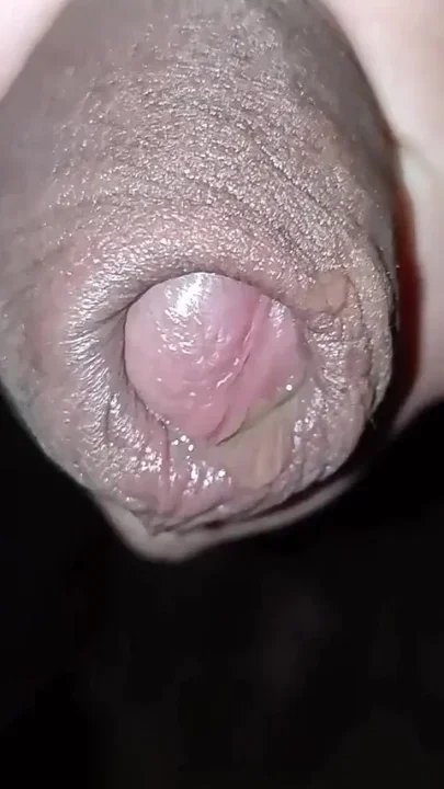 So Many Ropes of Piss Close up