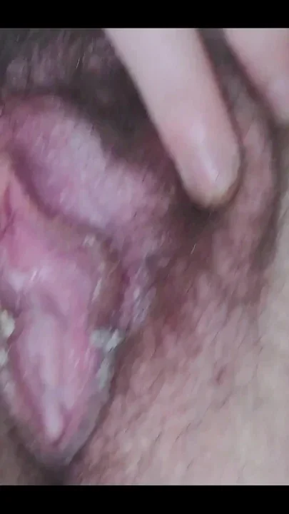 This Vagina Has Accumulated a Lot of Smegma These Days It's Here for You to
