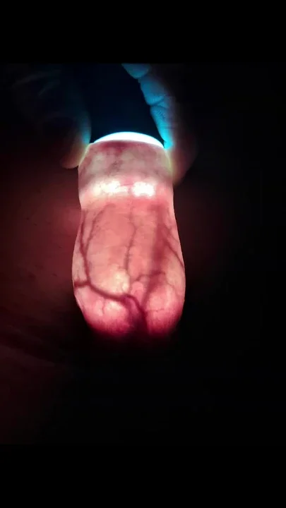 Lighting up my foreskin