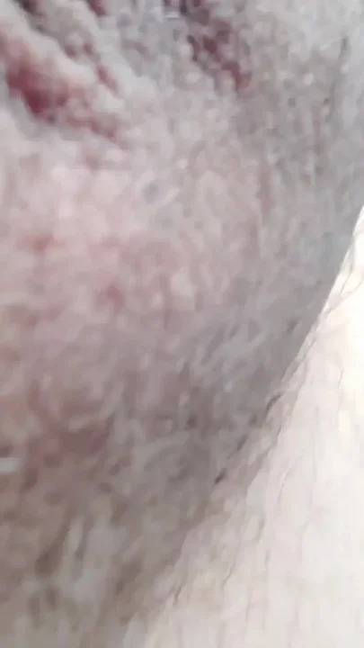 Seizure During Orgasm Epic